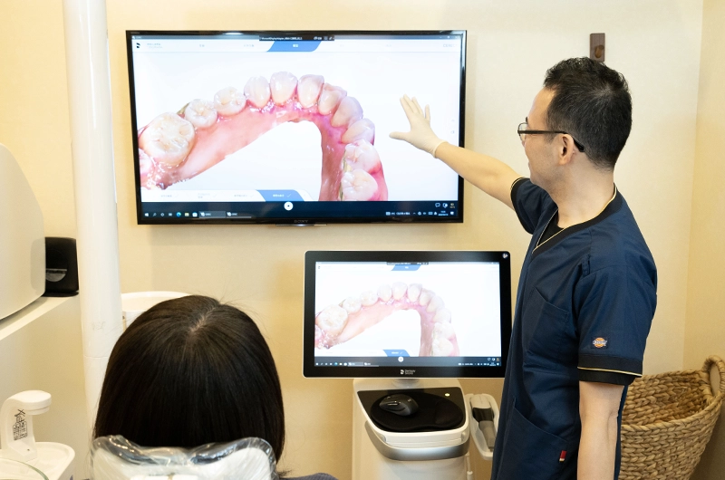 歯のひび割れ診断